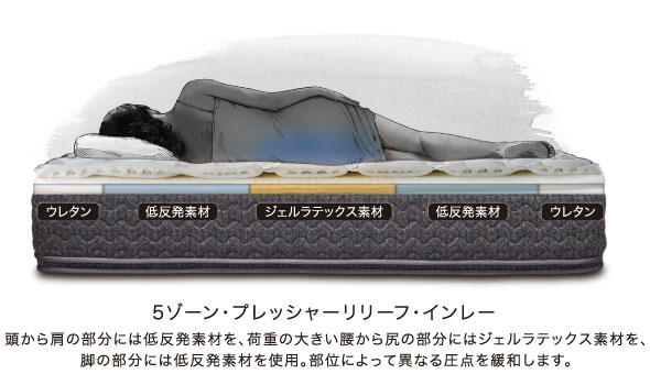 5ゾーンプレッシャーリリーフ・インレー